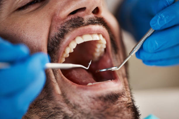 Best Emergency Cosmetic Dentistry (e.g., broken veneers) in Mcgovern, PA