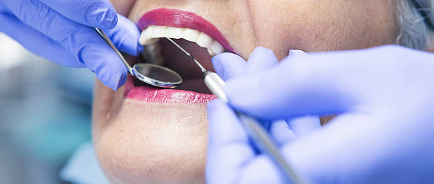 Best Knocked-Out Tooth (Avulsed Tooth) Treatment in Mcgovern, PA